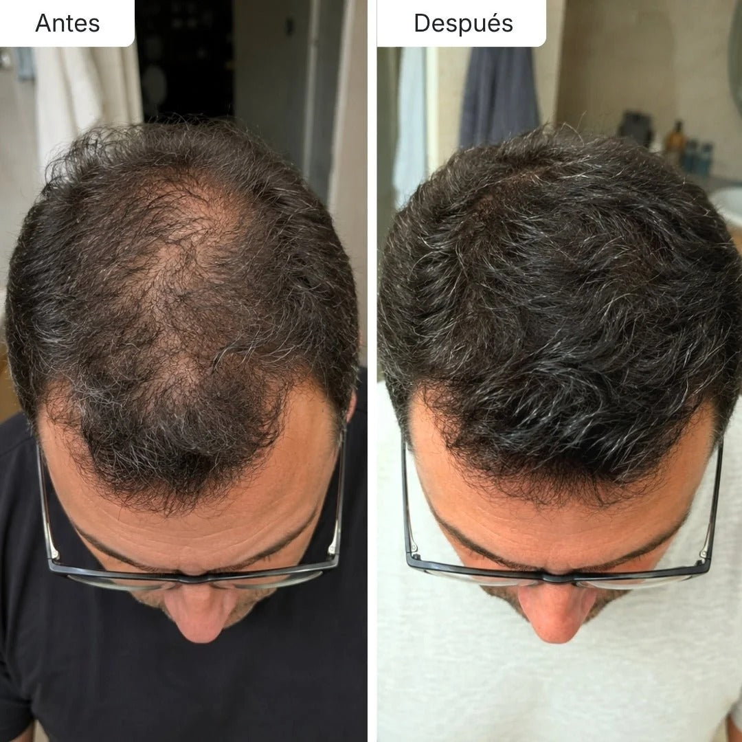 Sérum Anticaída de Doble Acción | Biolabs™