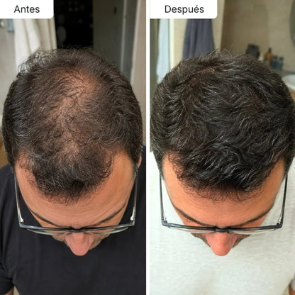 Sérum Anticaída de Doble Acción | Biolabs™